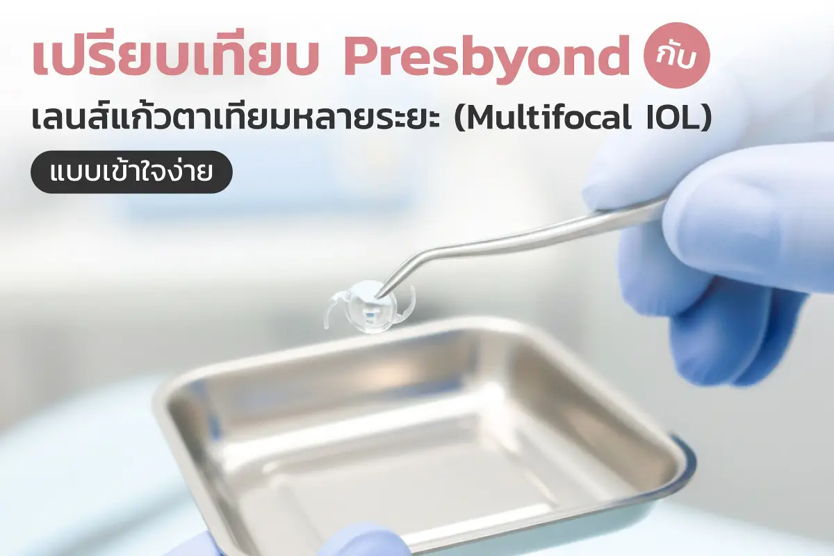  เปรียบเทียบ Presbyond กับเลนส์แก้วตาเทียมหลายระยะ